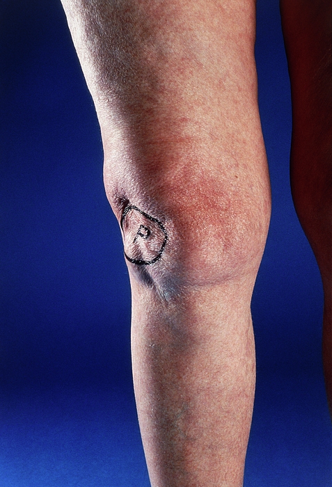 Dislocated leg discount