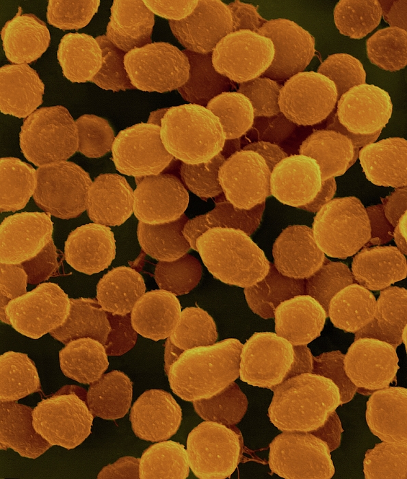 methanococcus