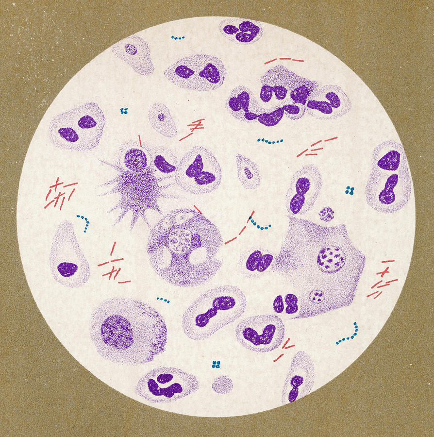 Bacillus Of Tuberculosis, Discovered Drawing by Mary Evans Picture ...