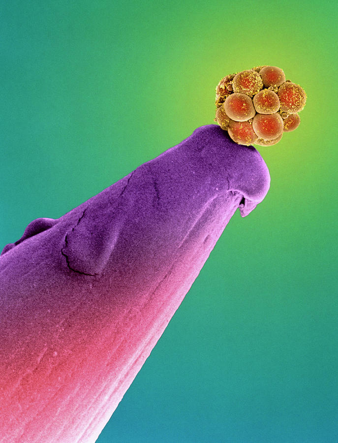 16-cell Human Embryo On A Pin Photograph by Dr Yorgos Nikas