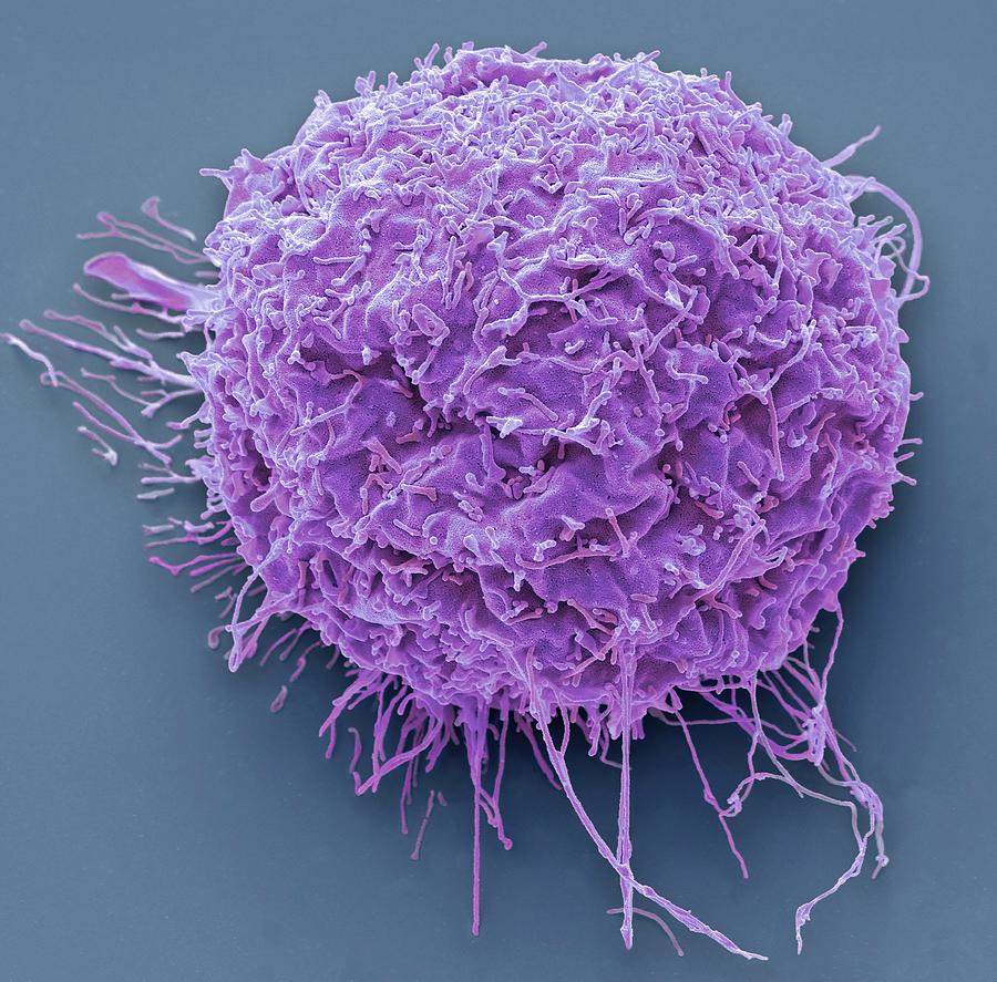 293t Cells In Culture #1 by Steve Gschmeissner/science Photo Library