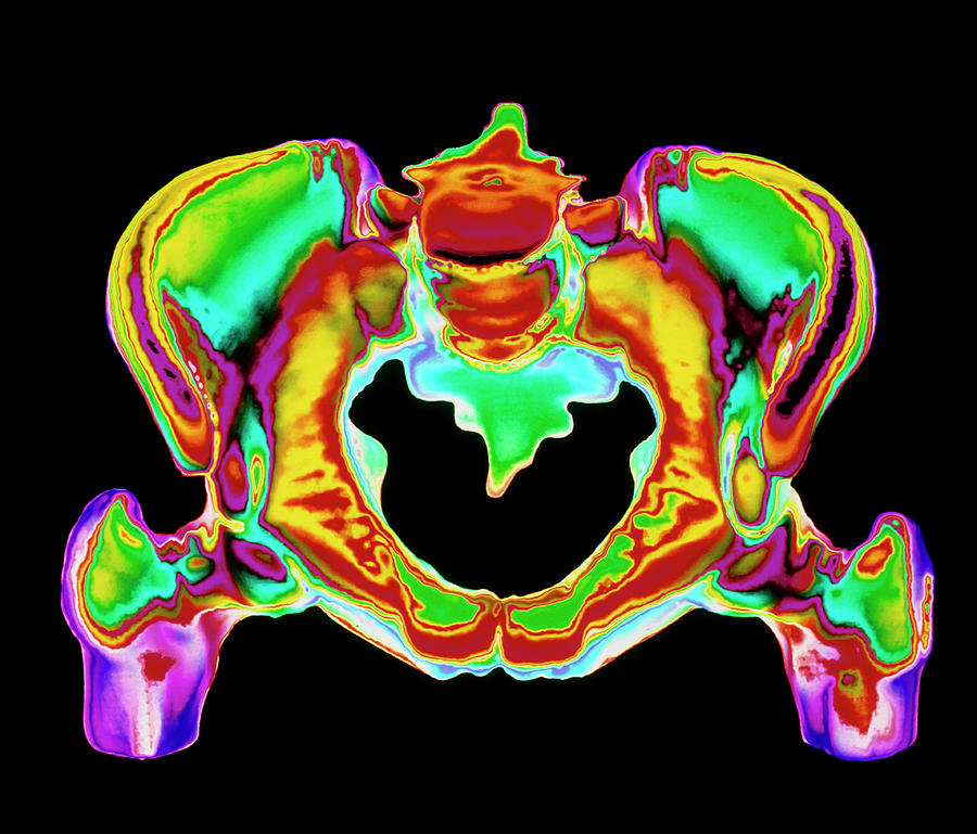 Normal Pelvic Anatomy 5472