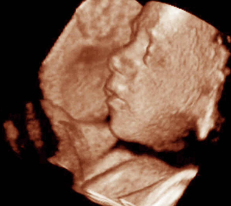 3-d Foetal Ultrasound #1 Photograph by Ge Medical Systems/science Photo Library