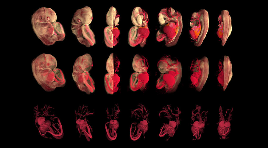 44-day-old Embryo Micro-mri #1 Photograph by Anatomical Travelogue