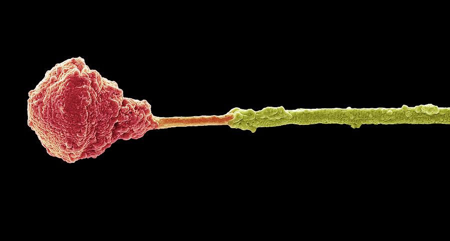 Abnormal Photograph - Abnormal Human Sperm Cell #1 by Steve Gschmeissner