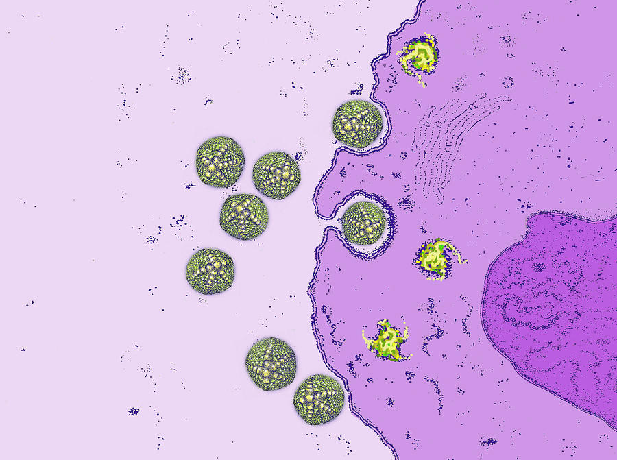 Adenovirus Infecting Gi Tract #1 Photograph by Chris Bjornberg