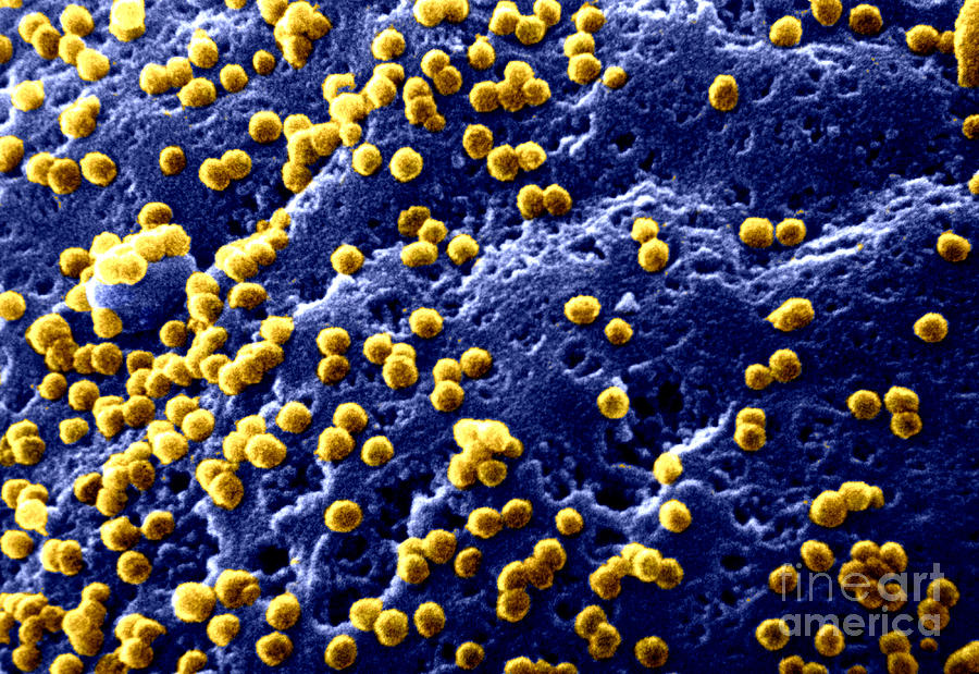 Aids Virus #1 Photograph by Dr. Cecil H. Fox