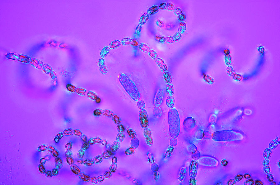 Nature Photograph - Anabaena Cyanobacteria #1 by Marek Mis