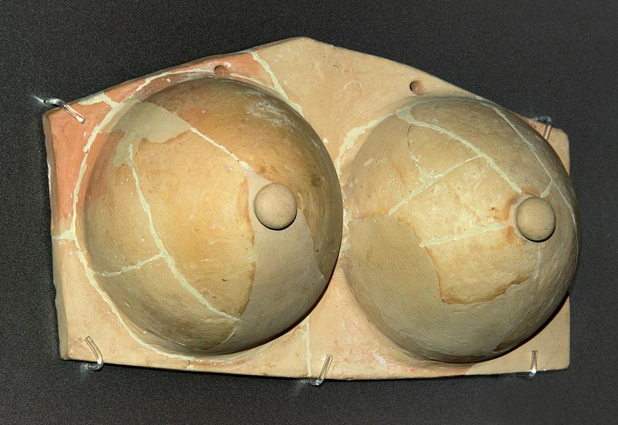Ancient Greek Breasts Votive Sculpture. #1 Photograph by David Parker/science Photo Library