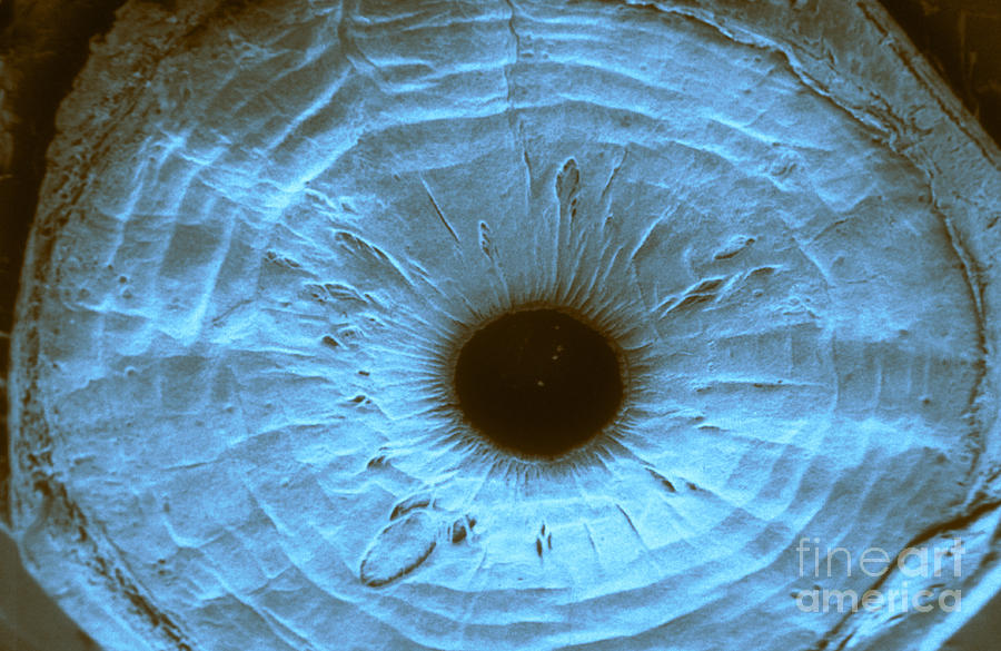 Anterior Surface Of Iris, Sem #1 Photograph by Ralph C. Eagle, Jr.