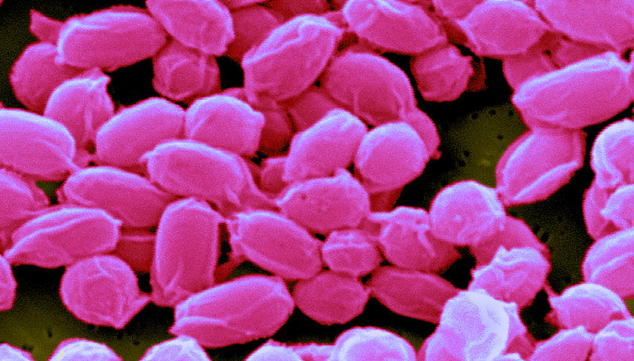 Anthrax, Bacillus Anthracis Bacteria #1 Photograph by Science Source