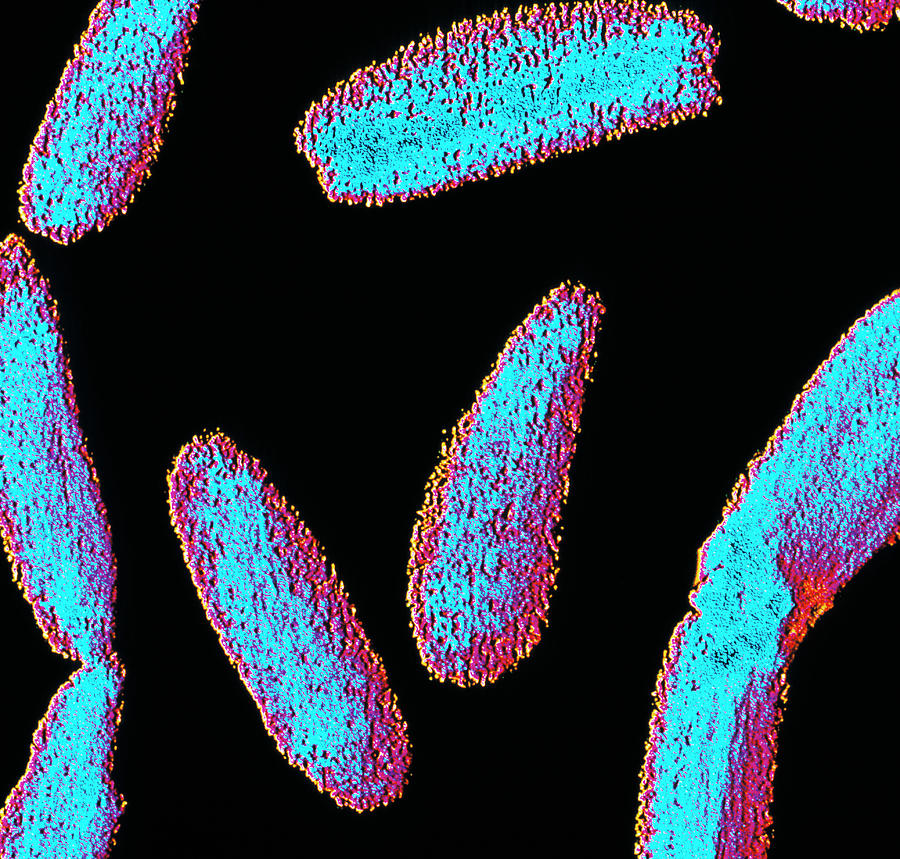 Anthrax Bacteria Photograph By Alfred Pasiekascience Photo Library Fine Art America 6816