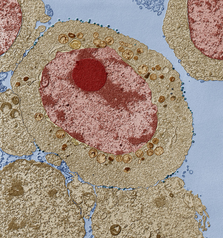 Apoptosis, Tem #1 Photograph by Eye of Science
