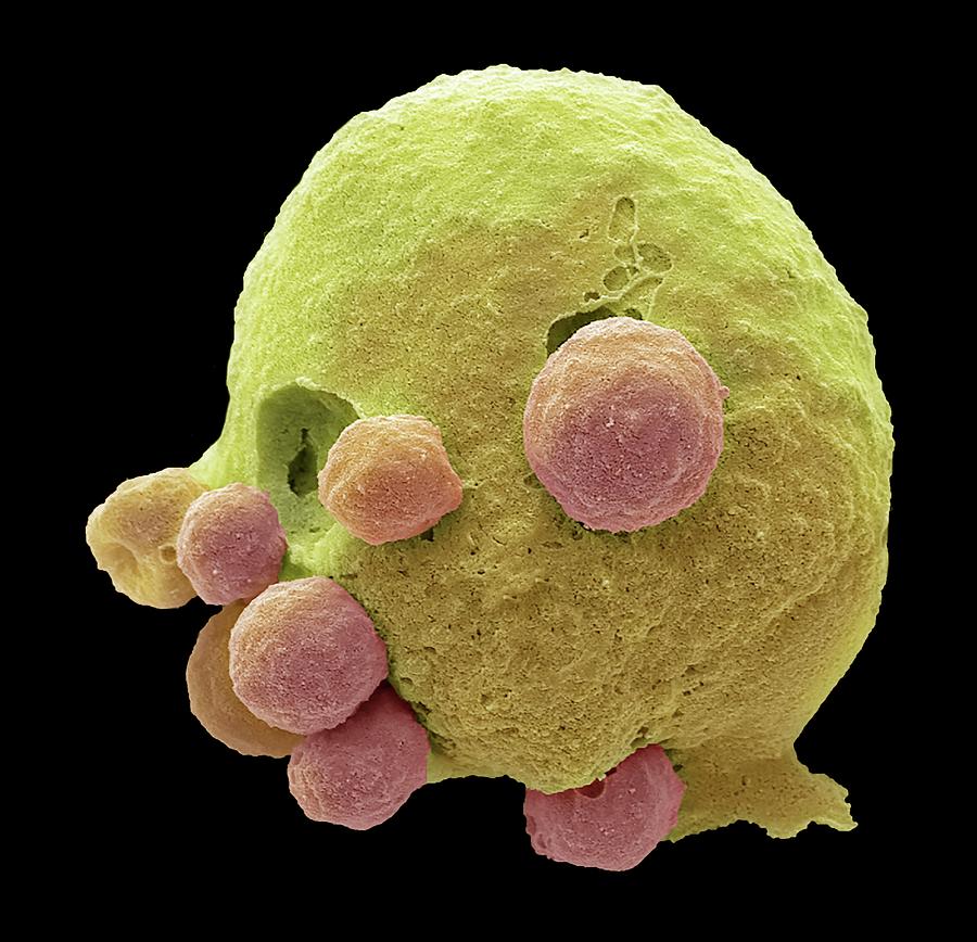 Apoptotic Cell Photograph By Steve Gschmeissnerscience Photo Library