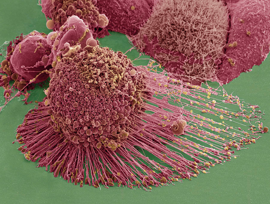 Apoptotic Hela Cell, Sem #5 Photograph by Science Source