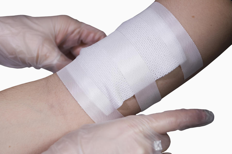 Applying Bandage #1 Photograph by Science Stock Photography