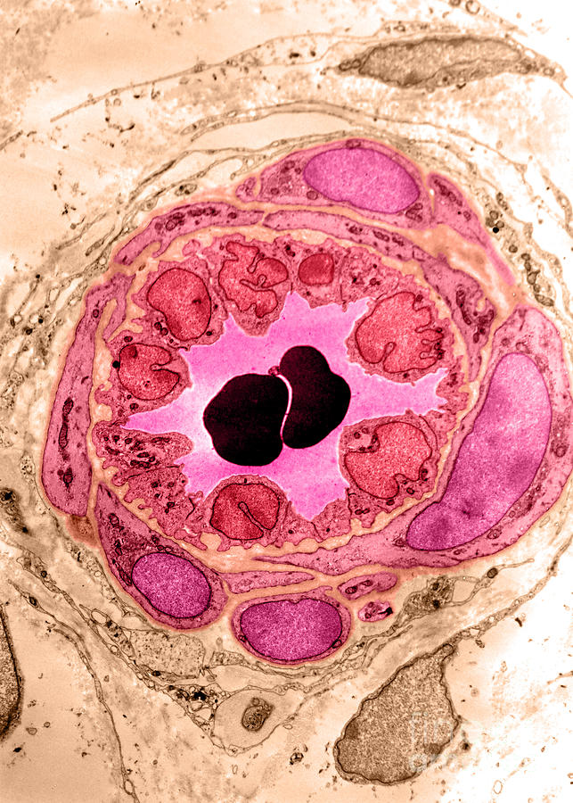 Electron Micrograph Photograph - Arteriole, Tem #1 by Don W. Fawcett