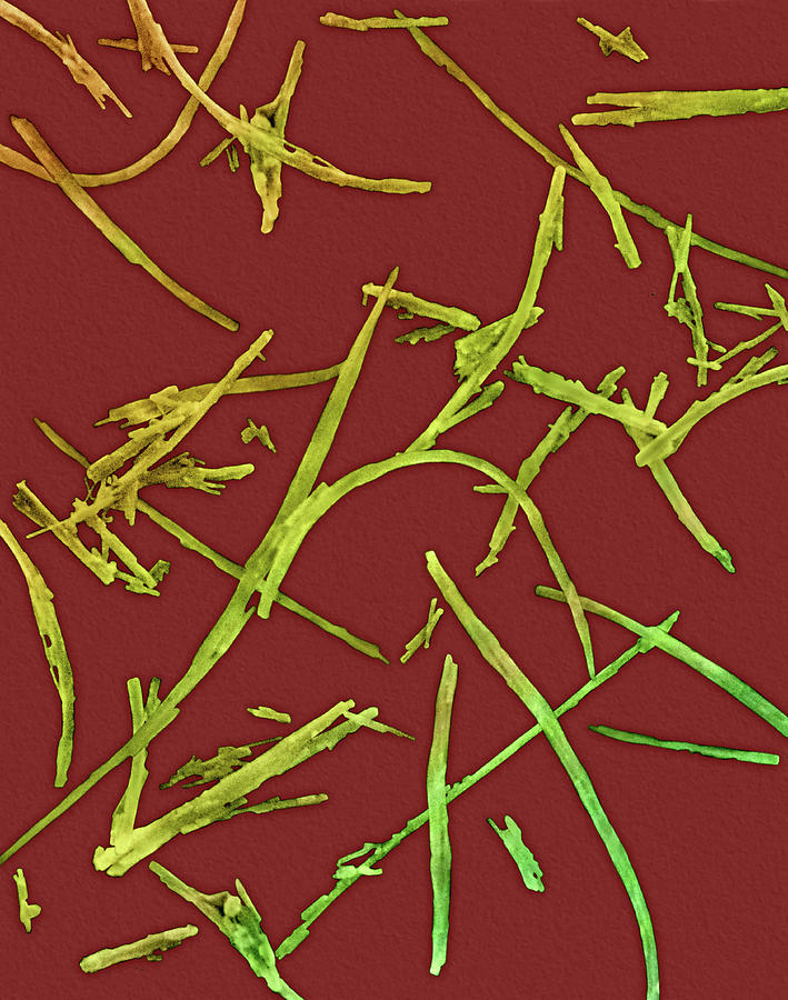 Asbestos Fiberschrysotile Type #1 Photograph by Dennis Kunkel Microscopy/science Photo Library