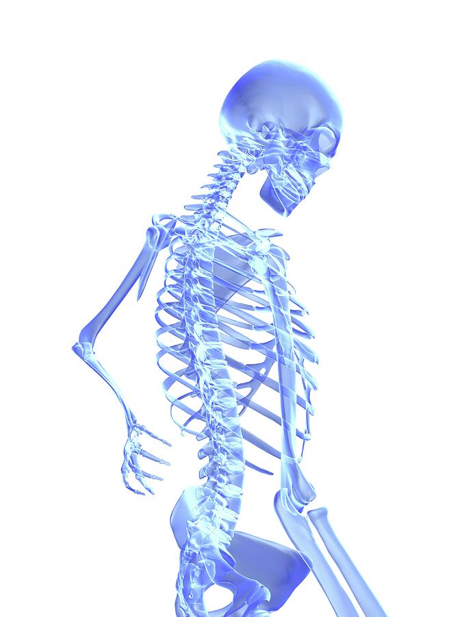Skeleton Photograph - Back Pain #1 by Alfred Pasieka