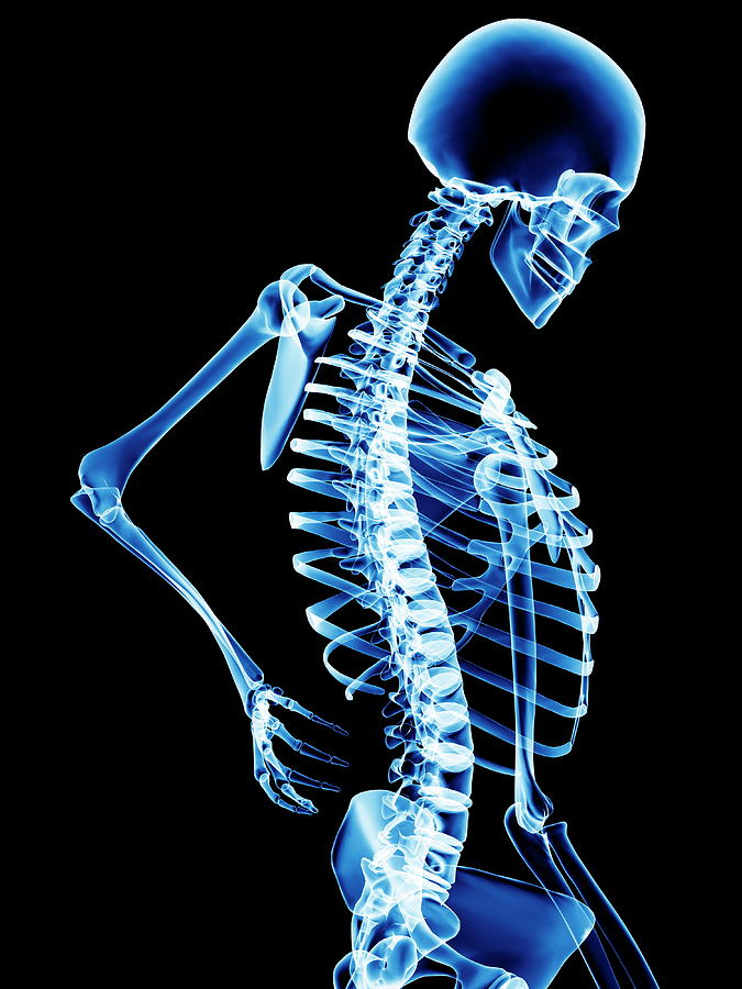 Skeleton Photograph - Back Pain #1 by Pasieka