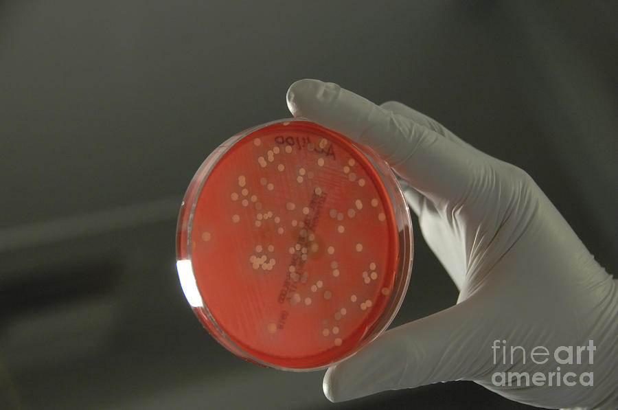 Bacteria From Human Skin Grown On Agar Photograph