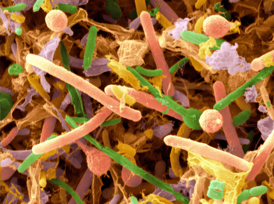 Bacteria In Hare Droppings, Sem #1 Photograph by Scimat