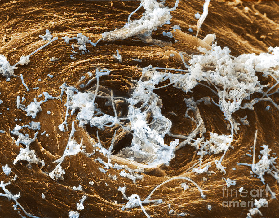 Sem Photograph - Bacteria On Skin #1 by David M. Phillips