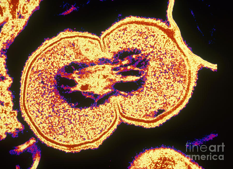 Bacterial Cell Undergoing Fission Tem #1 Photograph by Scott Camazine