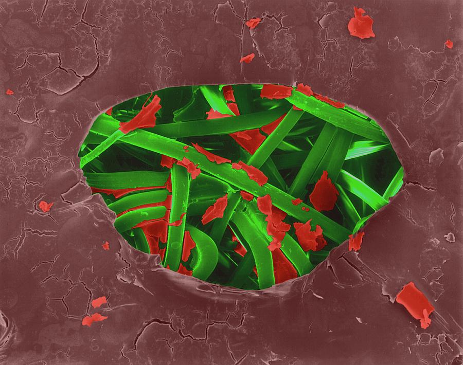 Band-aid With Dried Blood #1 Photograph by Dennis Kunkel Microscopy/science Photo Library