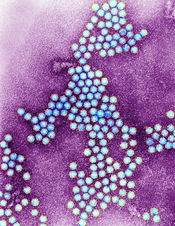 Beet Mild Yellowing Virus Photograph by Centre For Bioimaging ...