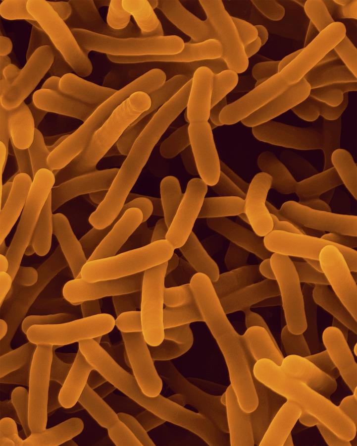 Bifidobacterium Animalis #1 Photograph by Dennis Kunkel Microscopy/science Photo Library