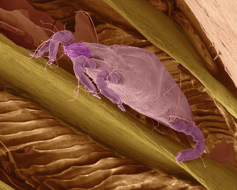 Bird Mite Between Feather Barbs #1 Photograph by Dennis Kunkel Microscopy/science Photo Library