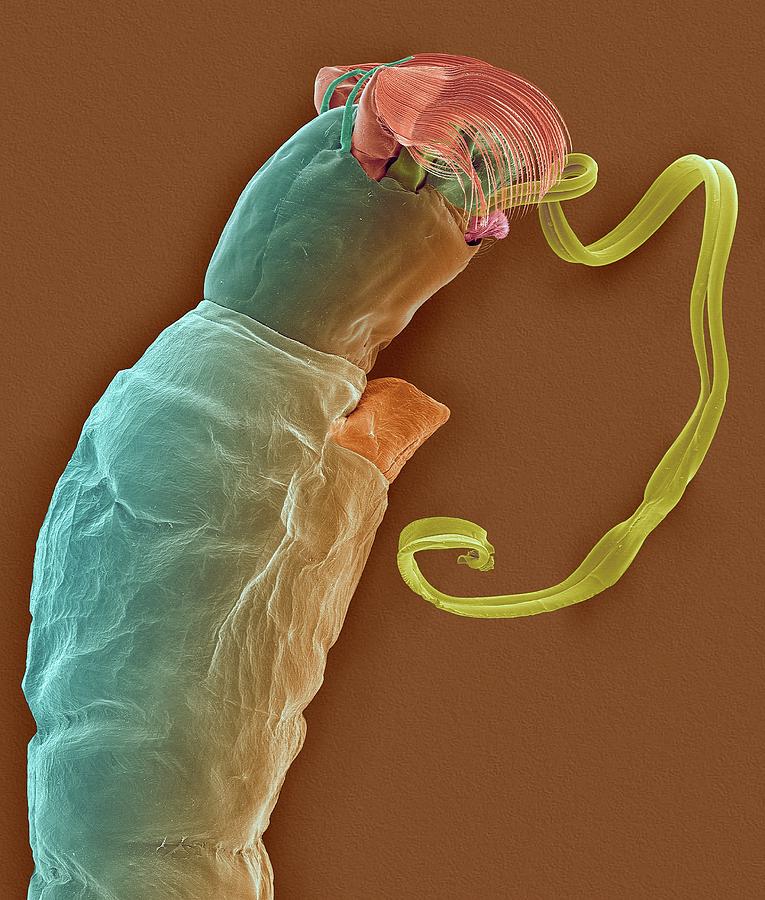 Black Fly Larva #1 Photograph by Dennis Kunkel Microscopy/science Photo Library