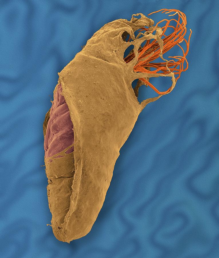 Black Fly Pupa #1 Photograph by Dennis Kunkel Microscopy/science Photo Library