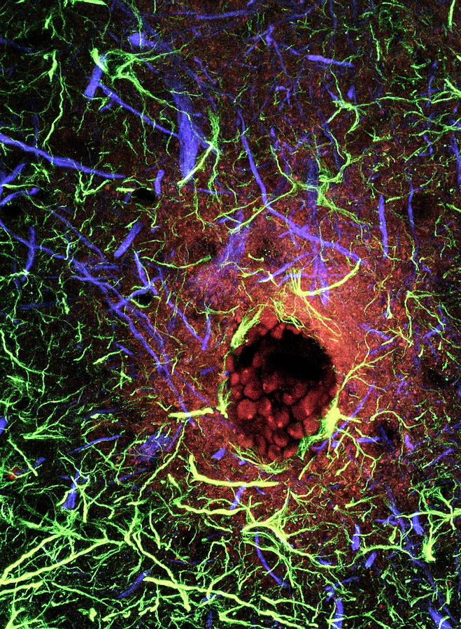 Blood-brain Barrier Breakdown #1 Photograph by C.j.guerin, Phd, Mrc Toxicology Unit/ Science Photo Library