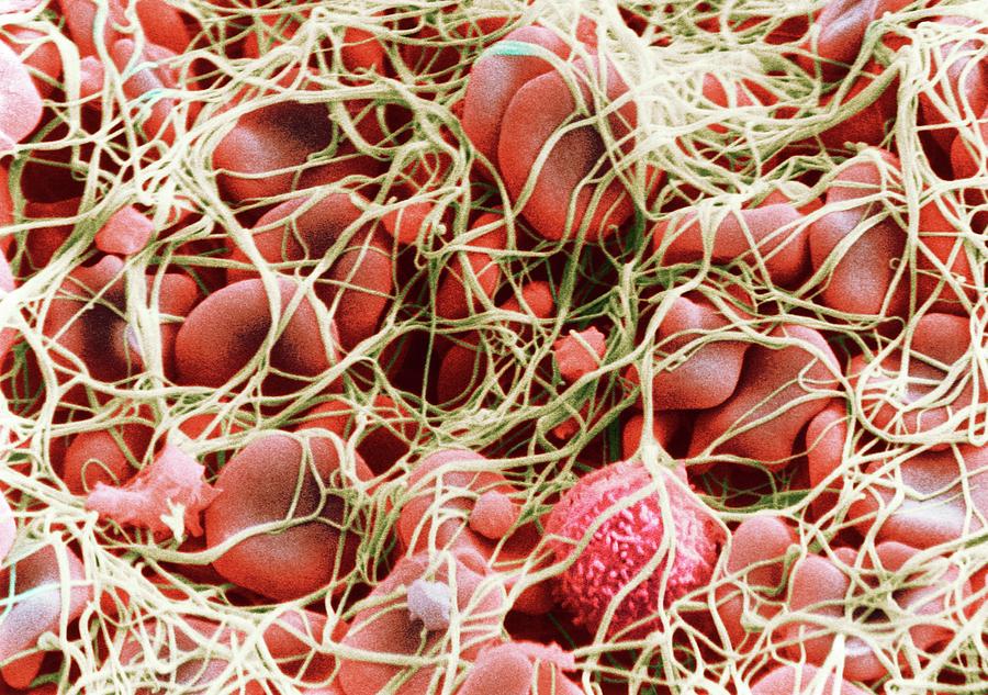 Blood Clot #1 Photograph by Secchi-lecaque/roussel-uclaf/col. V. Gremet/cnri/science Photo Library