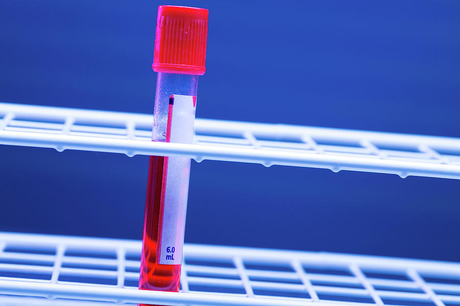 Nobody Photograph - Blood Sample In A Virology Tube #1 by Wladimir Bulgar/science Photo Library