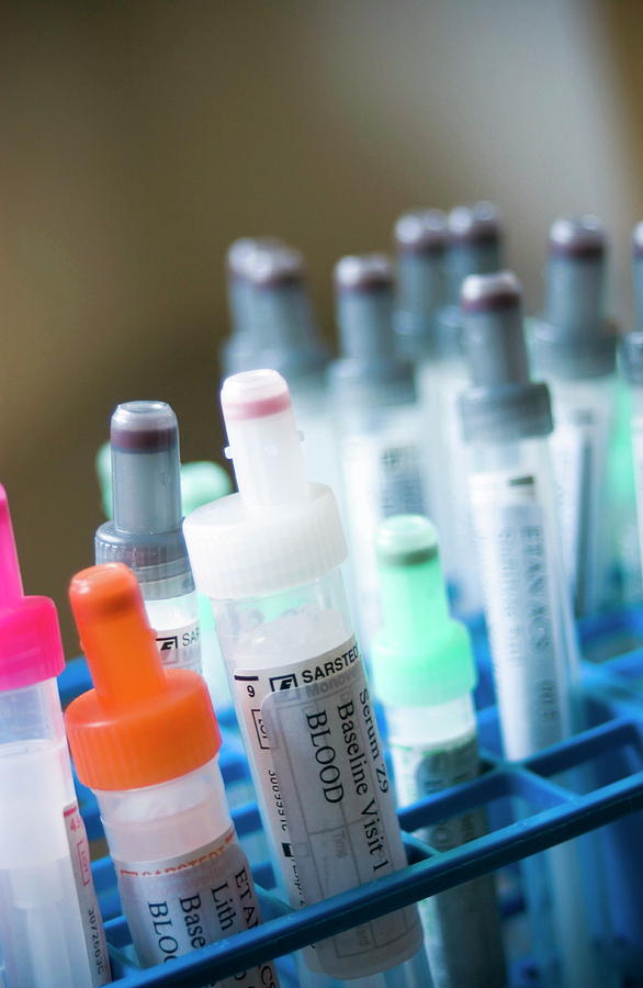 Blood Sample Tubes Photograph by Gustoimages/science Photo Library ...