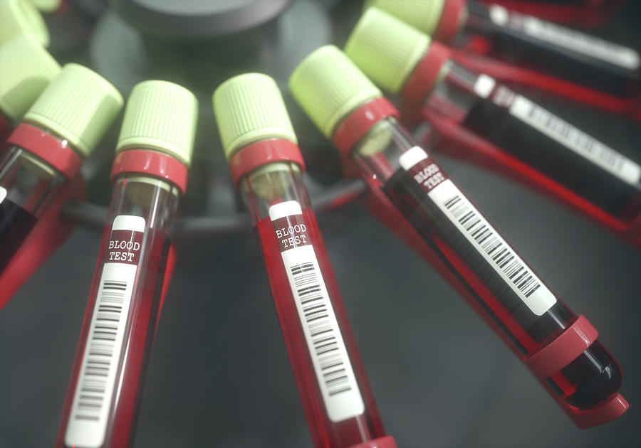 Blood Samples In Centrifuge Photograph by Ktsdesign/science Photo