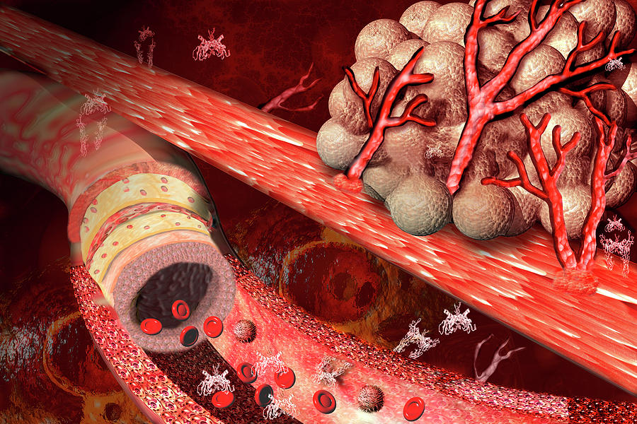 Blood Vessel Formation #1 Photograph by Carol & Mike Werner/science Photo Library