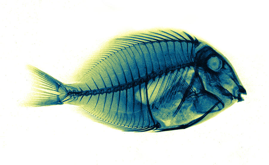 Bluelined Surgeonfish, X-ray, 1896 #1 Photograph by Science Source