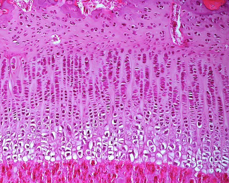 Bone Growth Plate #1 Photograph by Jose Calvo / Science Photo Library