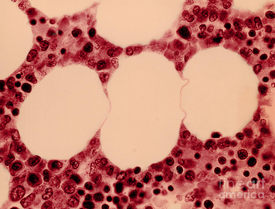 Bone Marrow & Fat Cells, Lm #1 Photograph by David M. Phillips