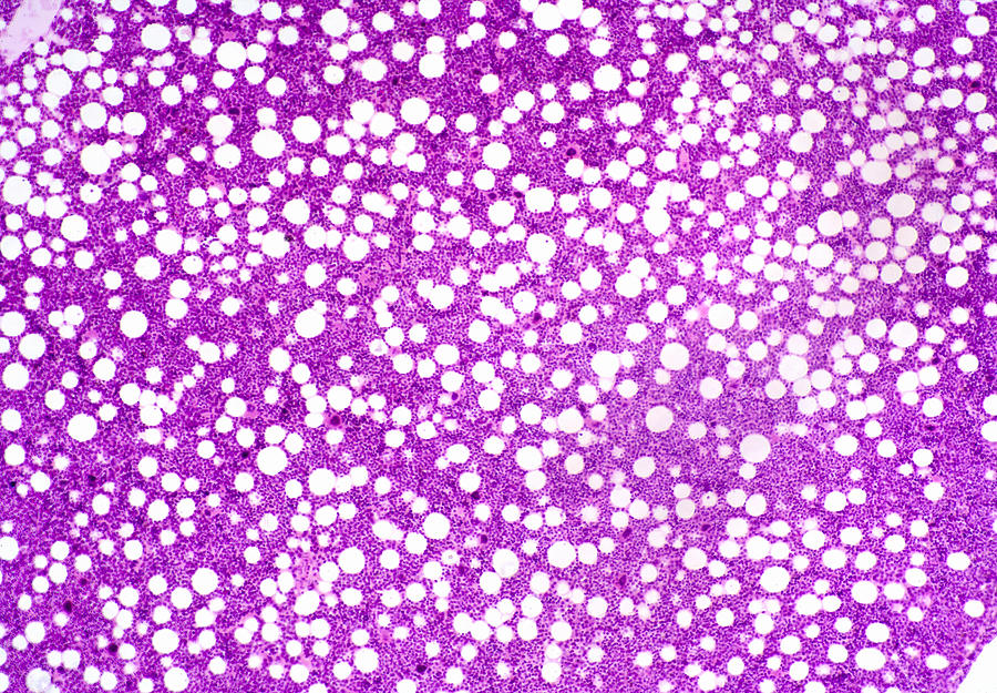 Bone Marrow Section, Lm #1 Photograph by Science Stock Photography