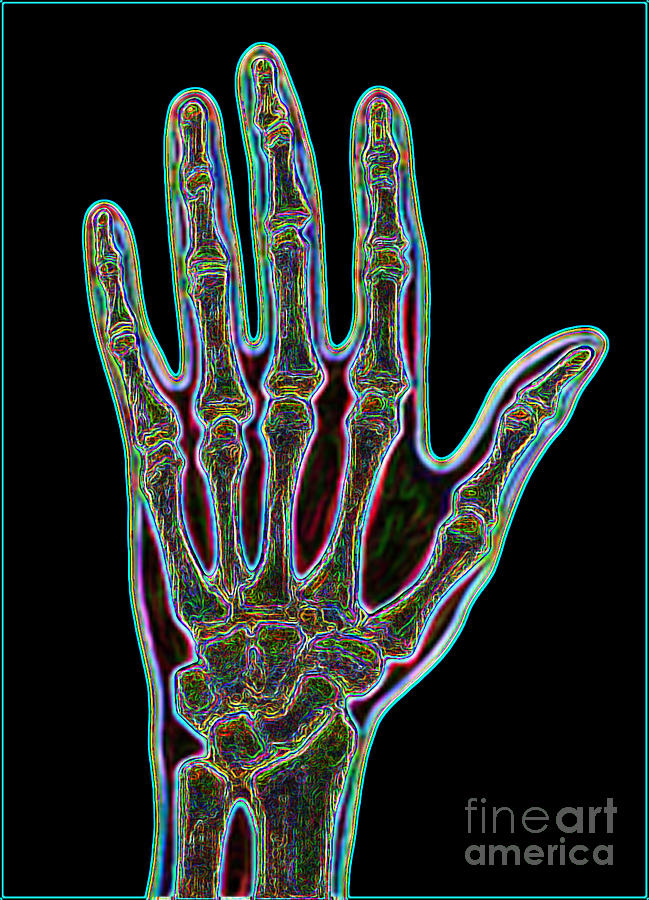 Bones Of The Hand #1 Photograph by Dennis Potokar