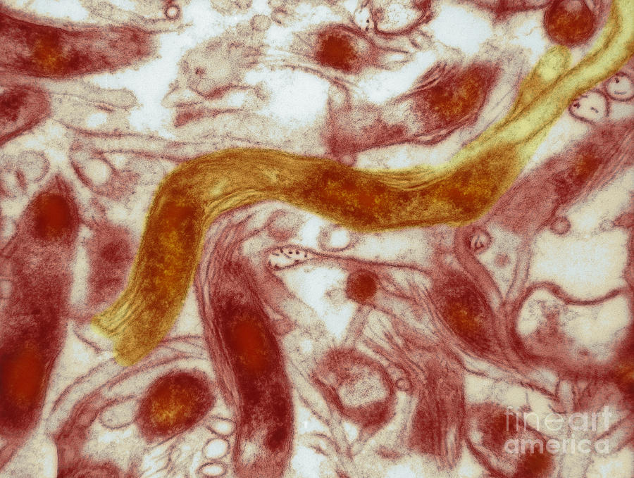 Borrelia Burgdorferi Lyme Disease, Tem #1 Photograph by David M. Phillips