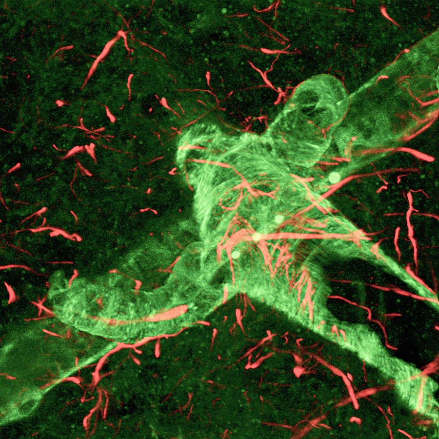 Brain Blood Vessels #1 Photograph by C.j.guerin, Phd, Mrc Toxicology Unit/ Science Photo Library