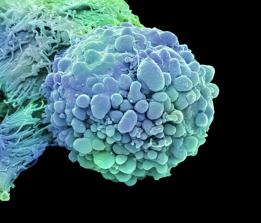 Brain Cancer Cell Photograph By Steve Gschmeissner Pixels