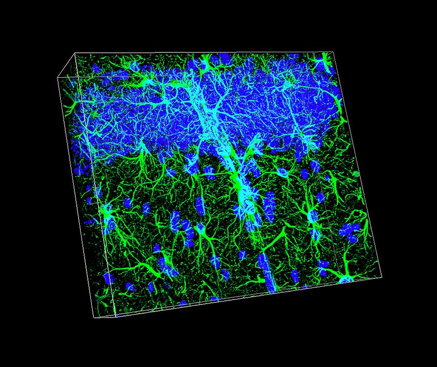 Brain Cells #1 Photograph by Dr. Chris Henstridge