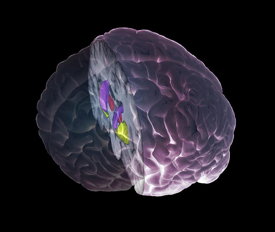 Brain Limbic System Photograph by Zephyr/science Photo Library